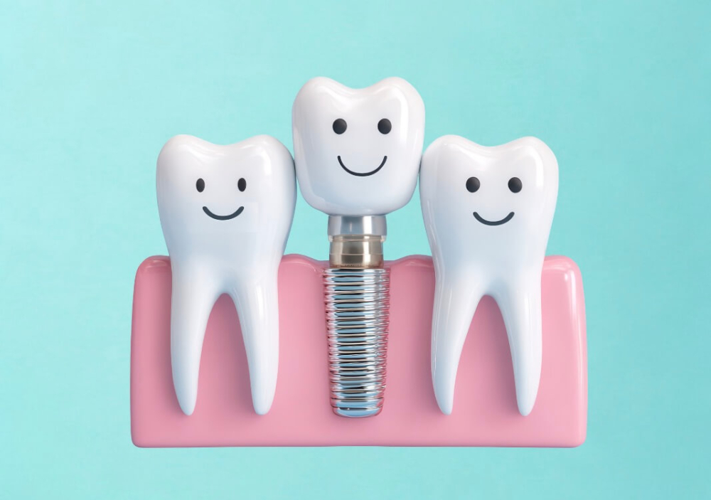 インプラントメンテナンス沖縄Micデンタル