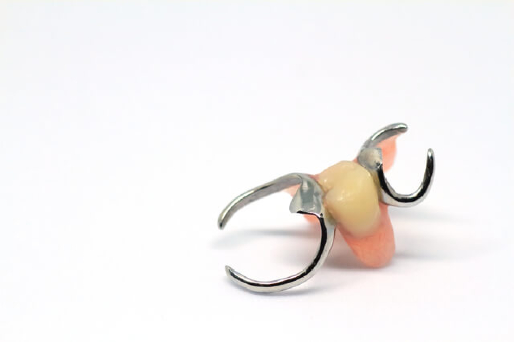 入れ歯についてmicデンタル沖縄インプラント