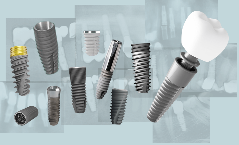 沖縄インプラントmicデンタルストローマン