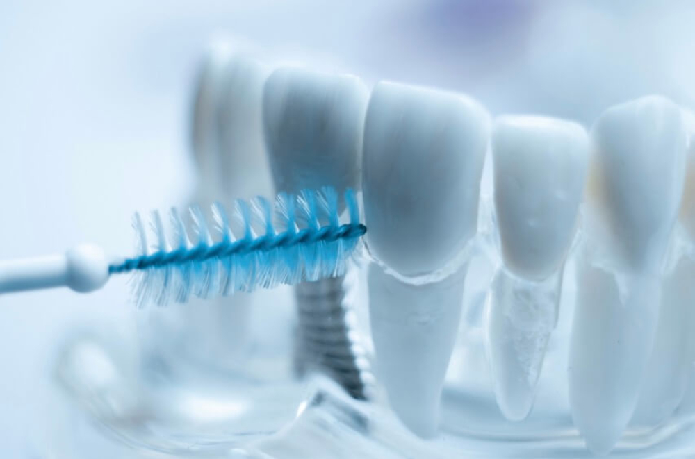 沖縄インプラントmicデンタルクリニック